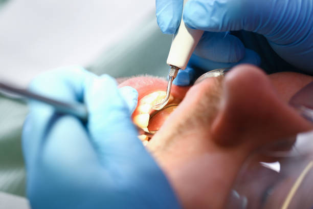 Best Emergency Treatment for Dental Infections or Abscesses in Minonk, IL